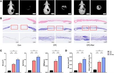 Naringenin is a Potential Anabolic Treatment for Bone Loss by Modulating Osteogenesis, Osteoclastogenesis, and Macrophage Polarization